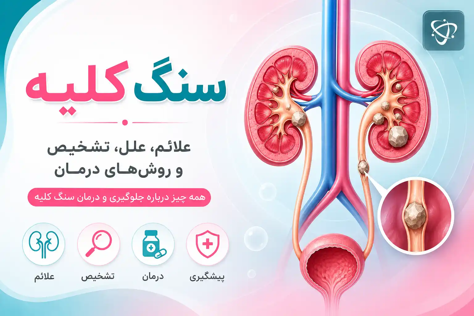 سنگ کلیه چیست - آرناپ