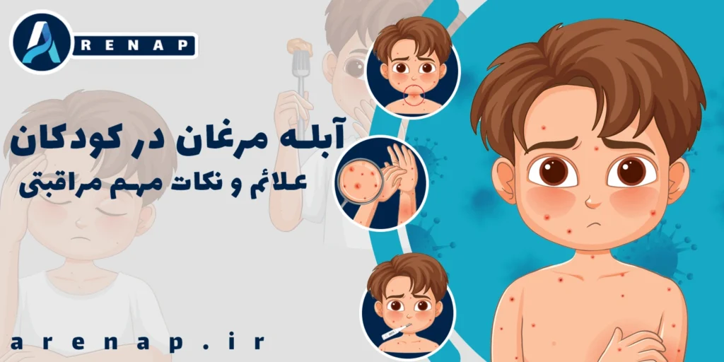 آبله مرغان چیست و چگونه در کودکان ظاهر می‌شود؛ ضایعات پوستی خارش‌دار