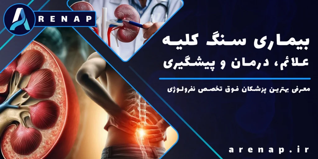 راهنمای جامع سنگ کلیه شامل علائم، علتها، انواع، درمان و پیشگیری