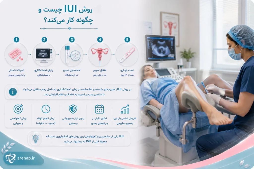 تلقیح داخل رحمی IUI و نحوه عملکرد آن - آرناپ
