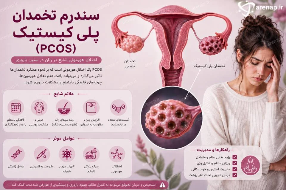 سندرم تخمدان پلی‌کیستیک PCOS از بیماری‌های شایع زنان