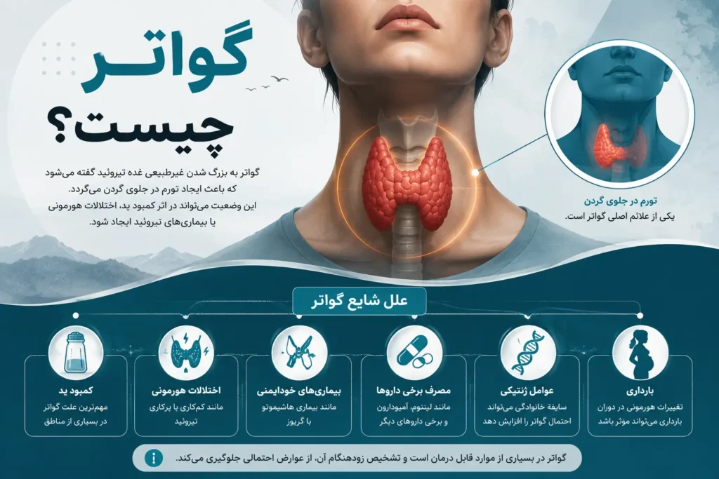 گواتر چیست؟-ارناپ