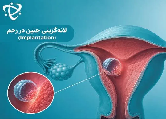 لانه‌گزینی جنین در رحم و ناباروری زنان