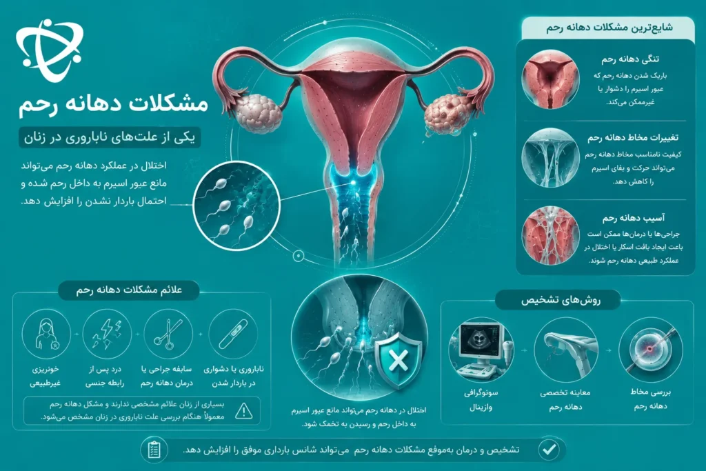تصویر پزشکی مشکلات دهانه رحم شامل تنگی دهانه رحم، تغییرات مخاط سرویکس و آسیب‌های دهانه رحم که می‌توانند عبور اسپرم را مختل کرده و یکی از علت‌های ناباروری در زنان باشند.