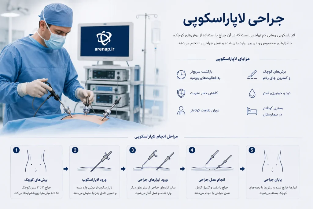 درمان ناباروری جراحی لاپاراسکوپی