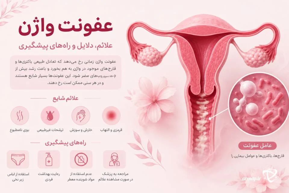 عفونت واژن از بیماری‌های زنان