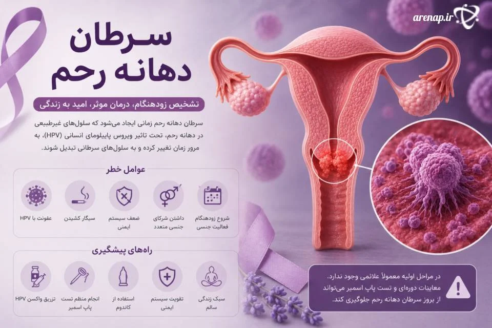 سرطان دهانه رحم از بیماری‌های جدی زنان