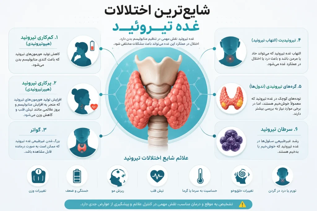 شایع‌ترین اختلالات غده تیروئید-ارناپ