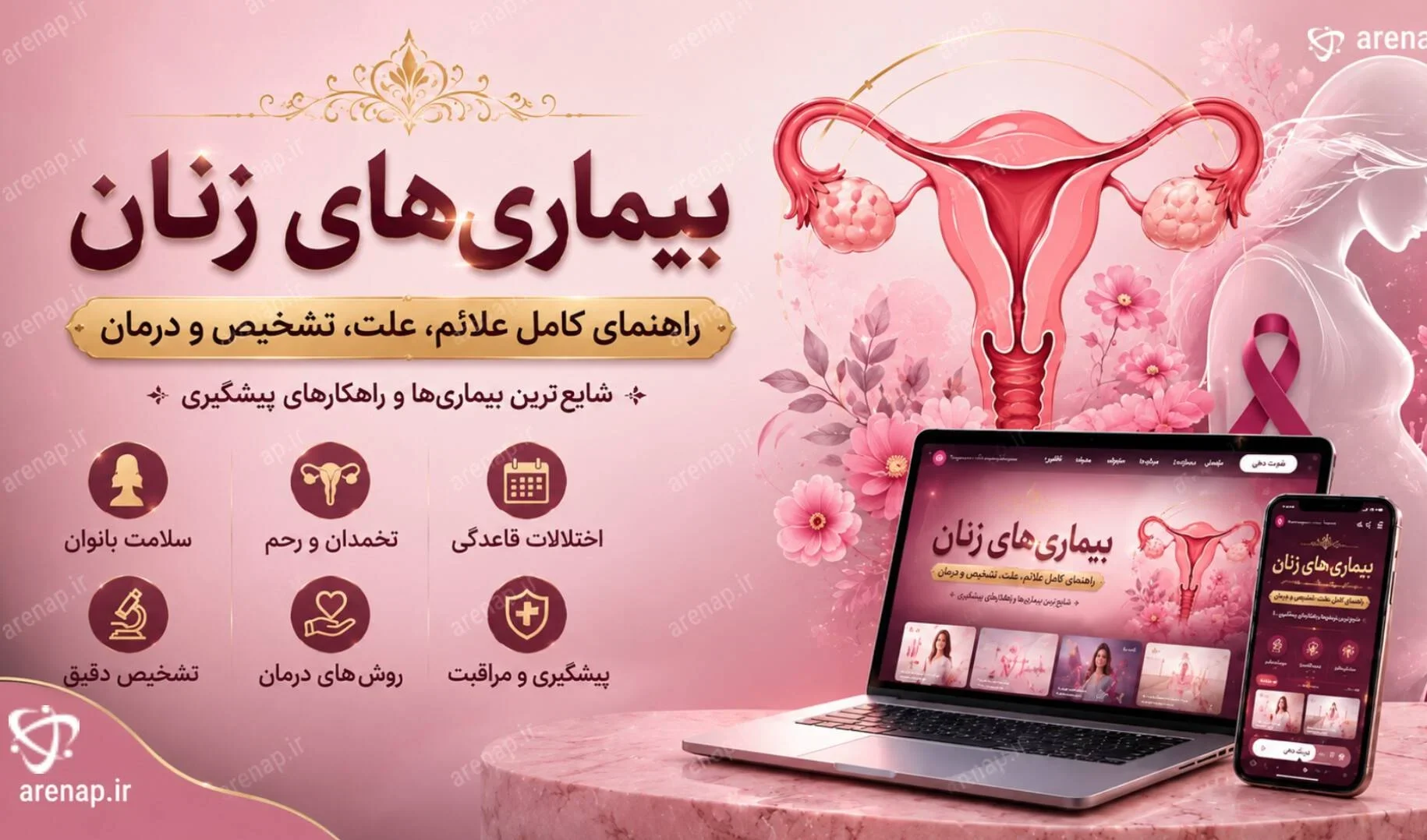 بیماری زنان - آرناپ