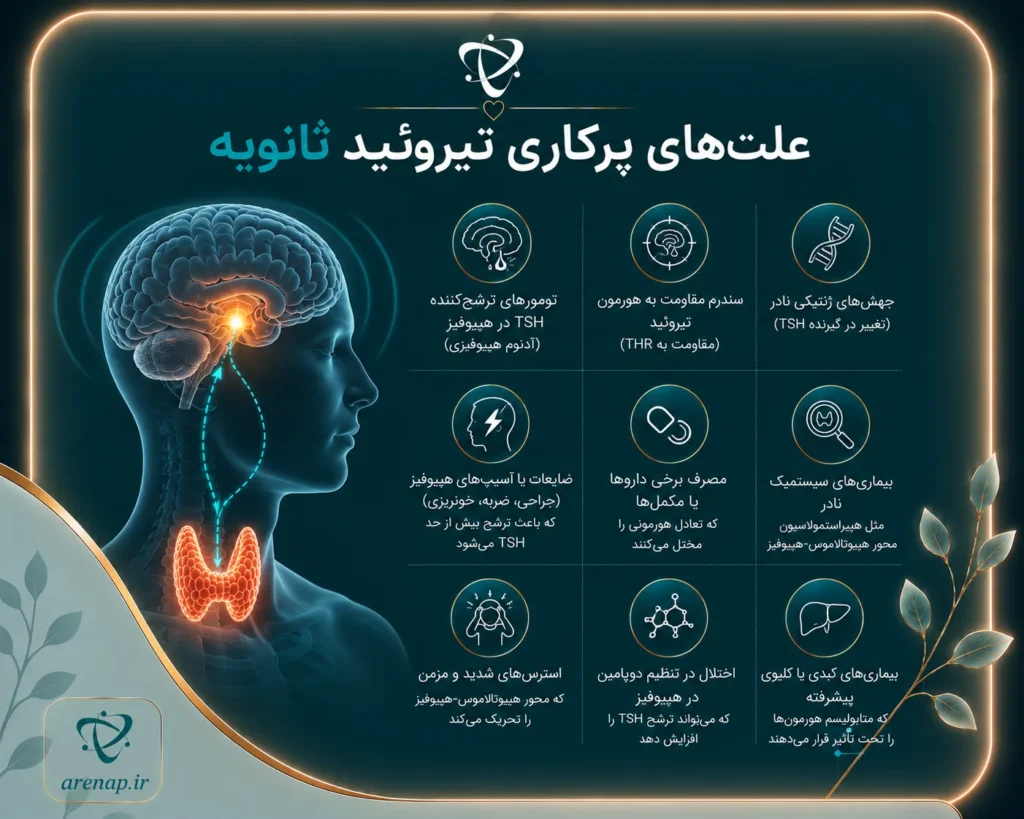 علت‌های پرکاری تیروئید ثانویه-آرناپ