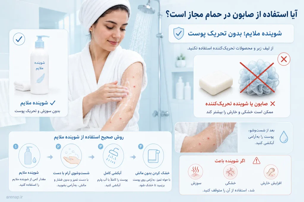 نحوه استفاده از صابون ملایم هنگام حمام در ابله مرغان و مراقبت از تاول‌ها