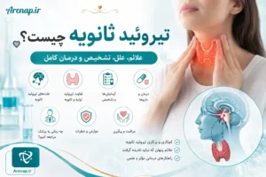 تیروئید ثانویه - آرناپ