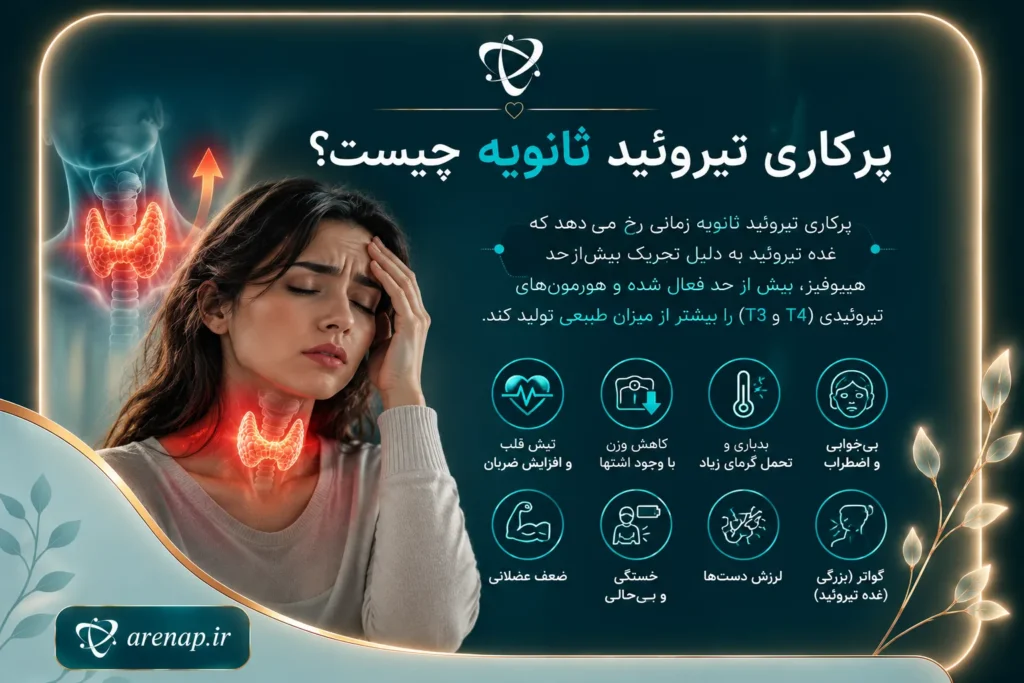 پرکاری تیروئید ثانویه چیست-آرناپ