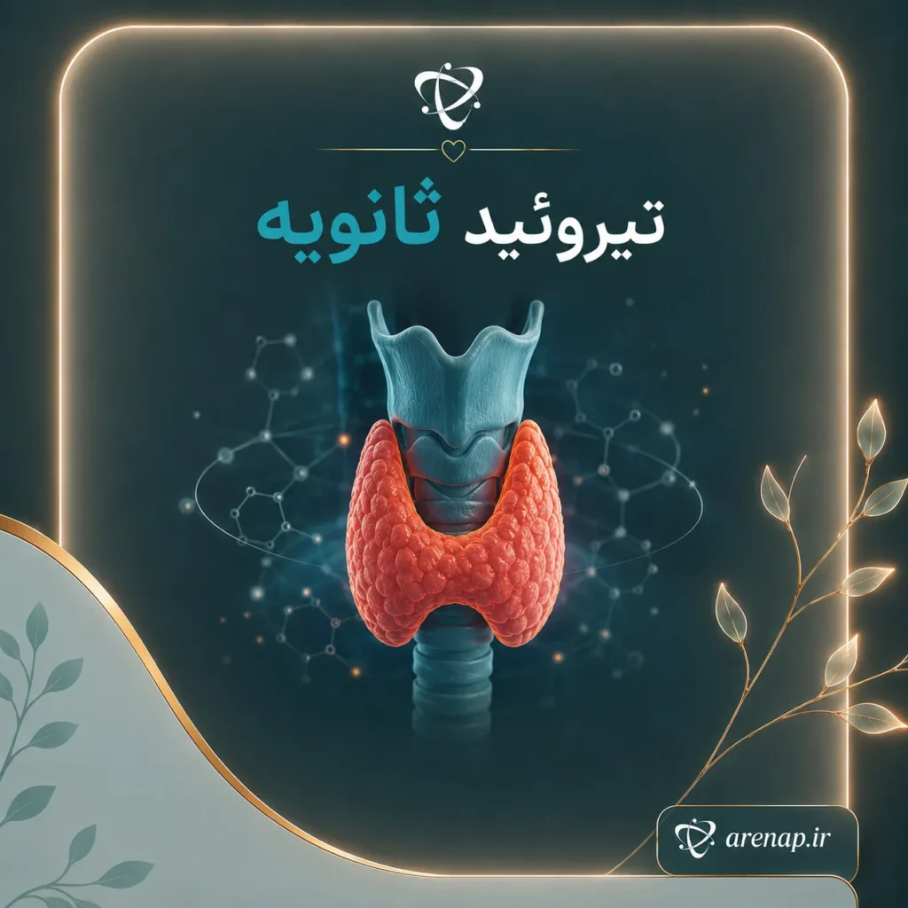 تیروئید ثانویه چیست-آرناپ