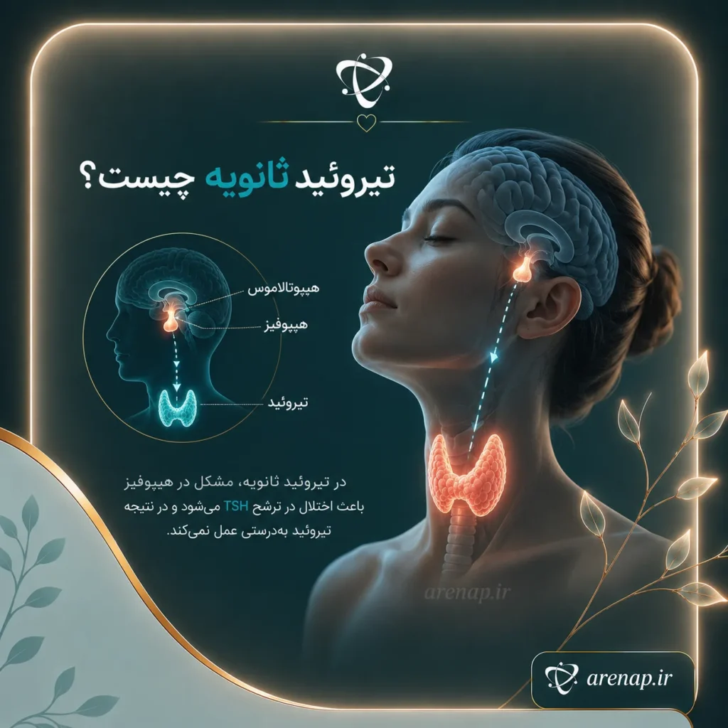 تیروئید ثانویه چیست-آرناپ