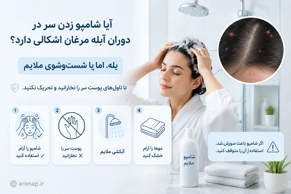 نحوه شستشوی سر و موها هنگام حمام در آبله مرغان بدون تحریک تاول‌ها