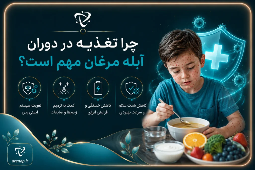 اهمیت تغذیه در دوران آبله مرغان برای تأمین مایعات، انرژی و پیشگیری از کم‌آبی