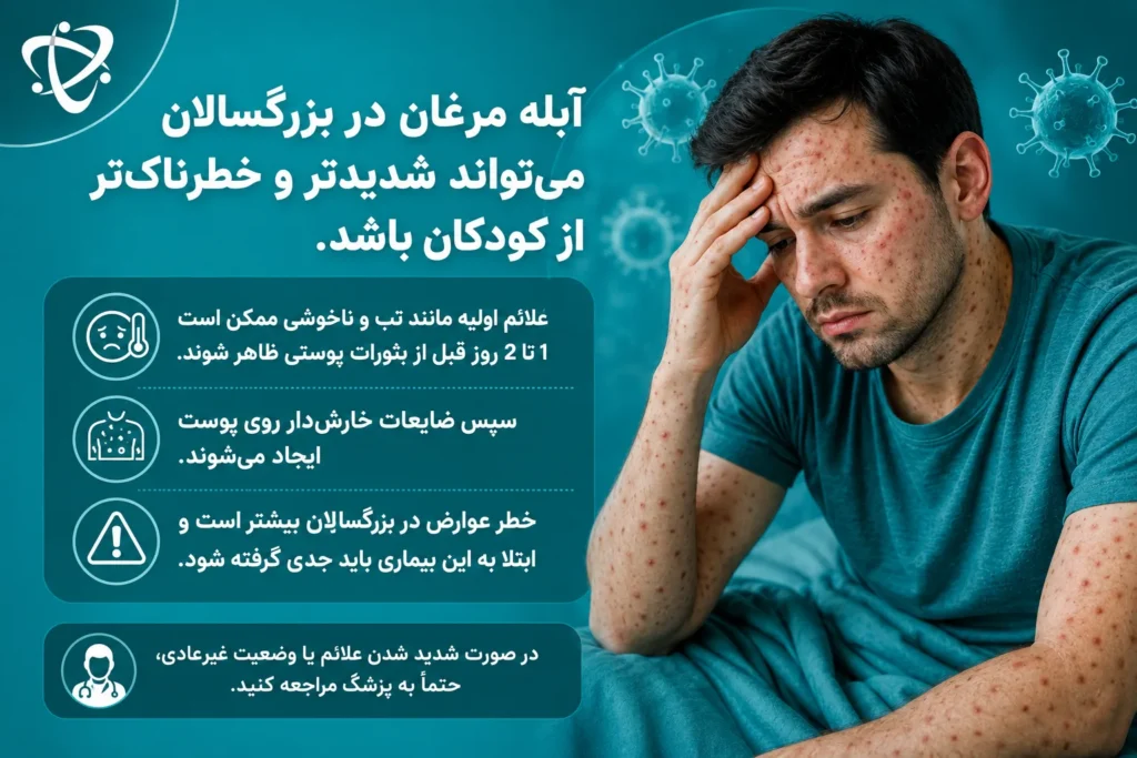 آبله مرغان در بزرگسالان چقدر خطرناک است؛ بررسی شدت بیشتر علائم و افزایش خطر عوارض نسبت به کودکان