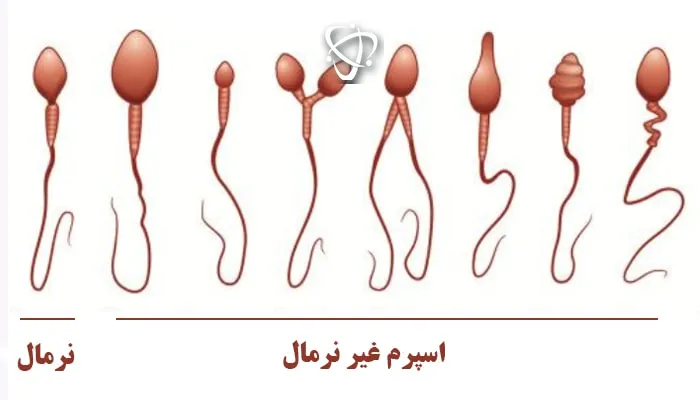 بررسی حرکت اسپرم در آزمایش اسپرموگرام و ارزیابی ناباروری مردان _ آرناپ