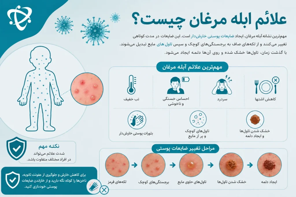 بثورات پوستی آبله مرغان در مراحل مختلف از لکه قرمز تا تاول و دلمه