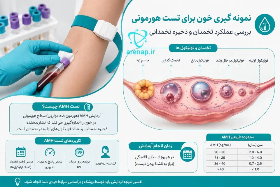 نمونه‌گیری خون برای آزمایش AMH و نمایش تخمدان و فولیکول‌ها - ارناپ