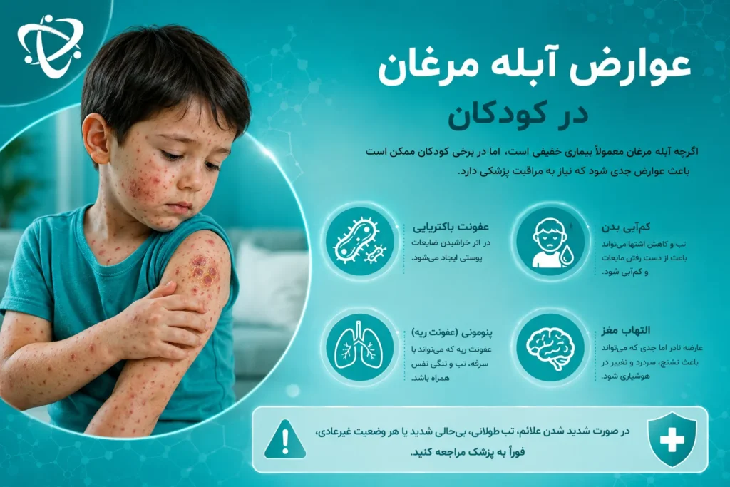 عوارض آبله مرغان در کودکان و علائم عفونت پوستی، کم‌آبی بدن، پنومونی و التهاب مغز