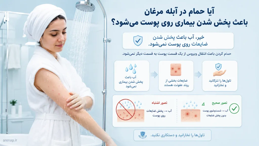 تصویر آموزشی حمام در آبله مرغان و تاثیر آب بر عدم پخش شدن ضایعات پوستی