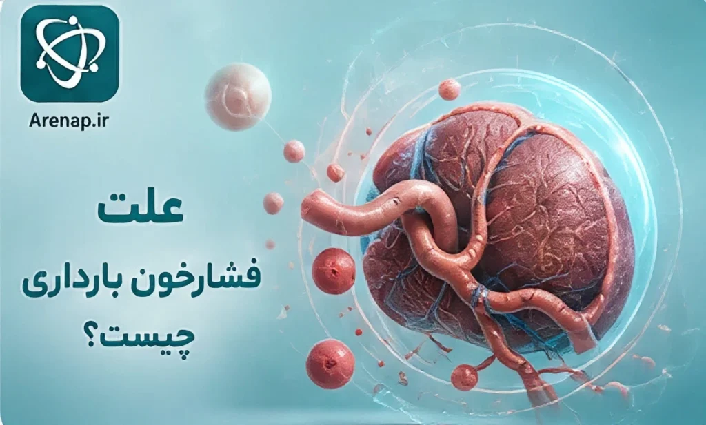 علت فشارخون بارداری-ارناپ
