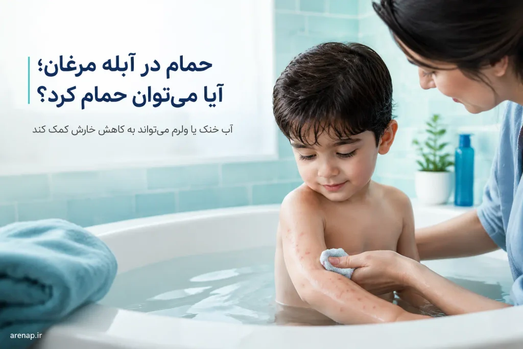 حمام در آبله‌مرغان؛ راهنمای مراقبت ملایم از کودک هنگام استحمام.