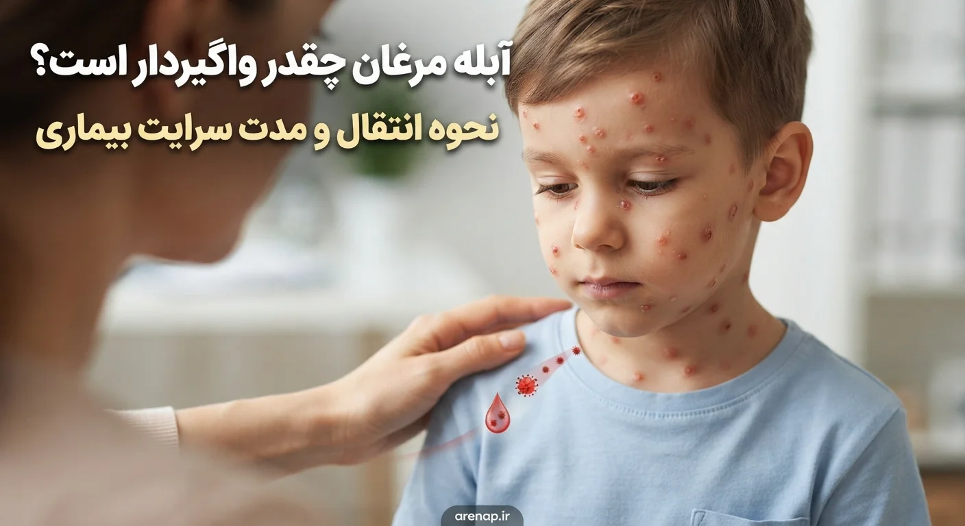 آبله مرغان واگیردار - آرناپ