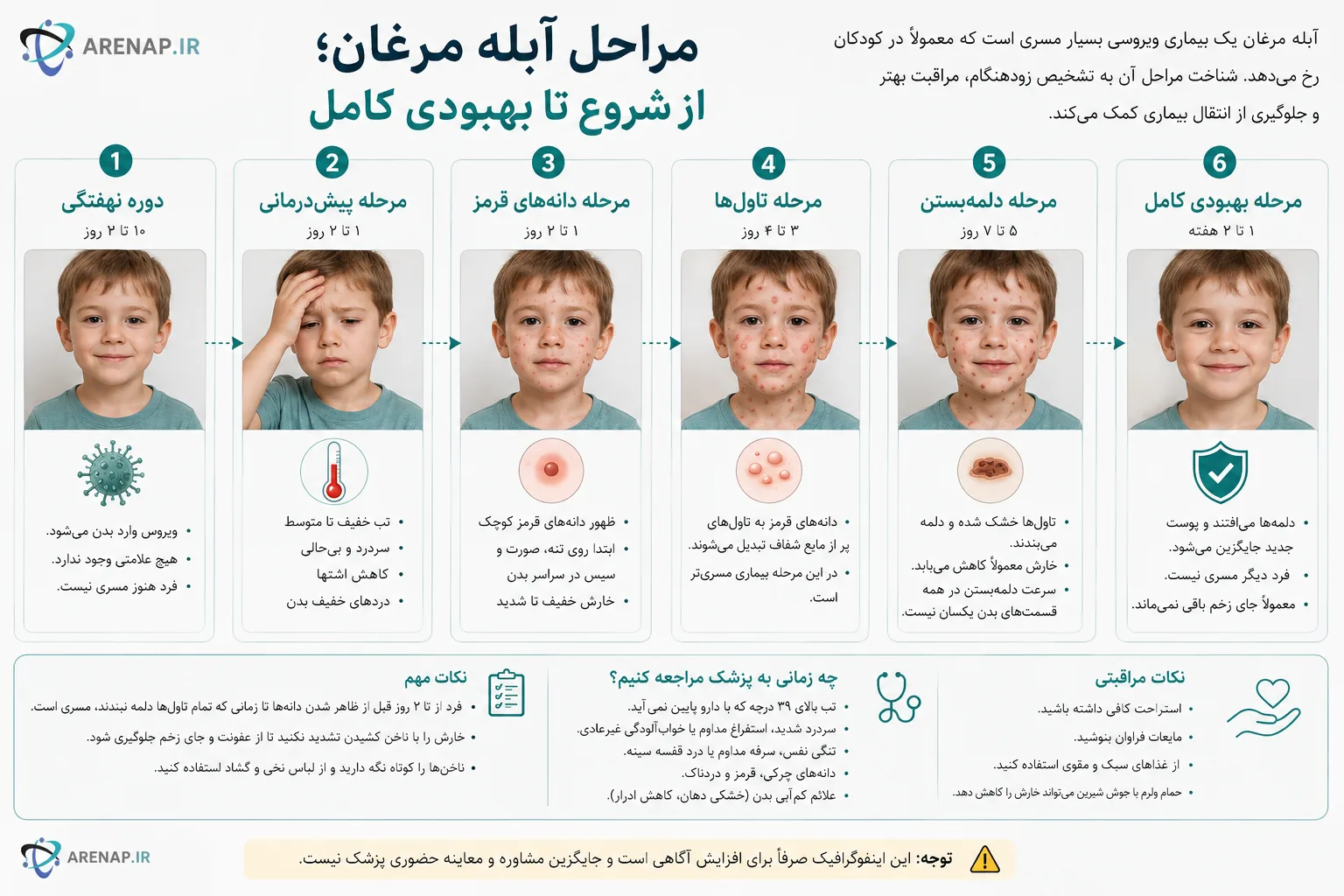 مراحل آبله مرغان، از شروع تا بهبودی