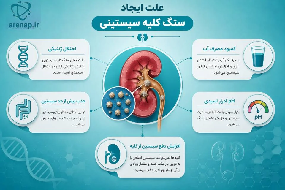 علت تشکیل سنگ سیستینی و نقش سیستینوری -ارناپ