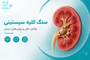 سنگ کلیه سیستینی - آرناپ