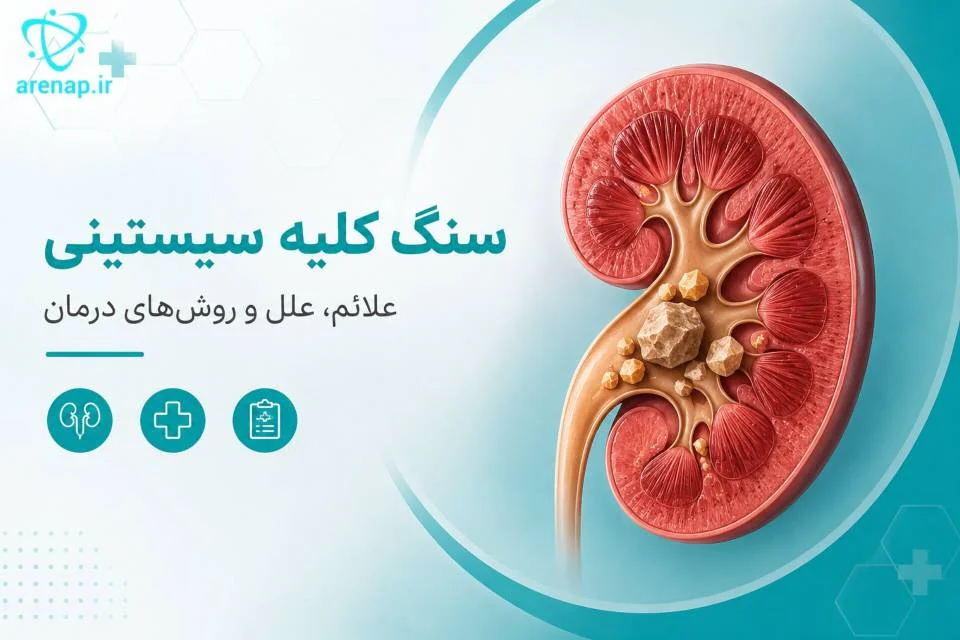 سنگ کلیه سیستینی - آرناپ