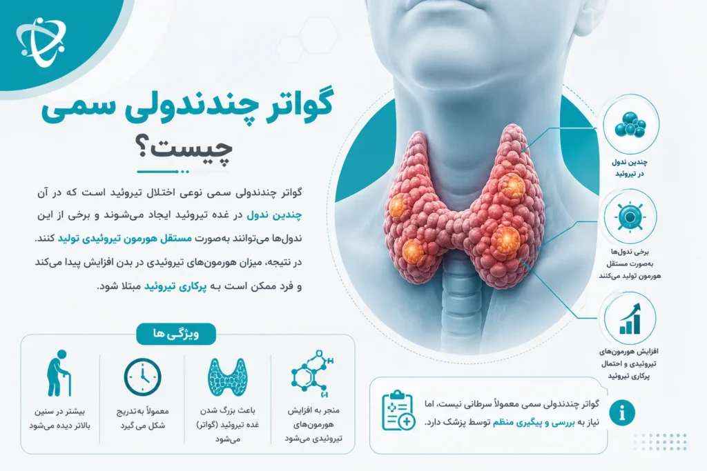 گواتر چندندولی سمی؛ علت مهم تیروئید سمی و پرکاری تیروئید