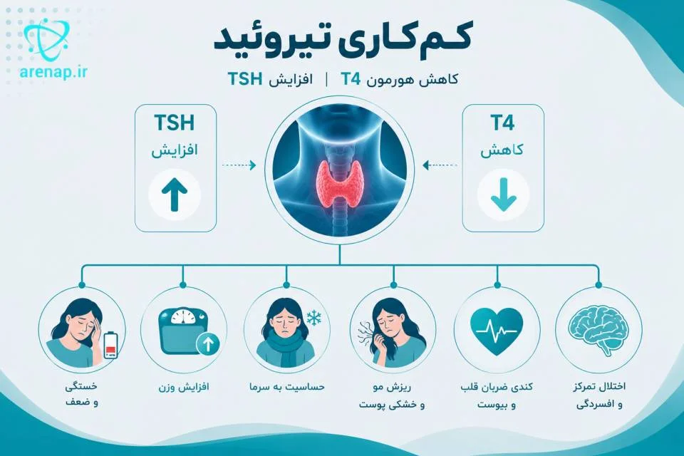 اینفوگرافیک کم‌کاری تیروئید با افزایش TSH و کاهش T4 و علائم مرتبط با اختلال عملکرد تیروئید -ارناپ