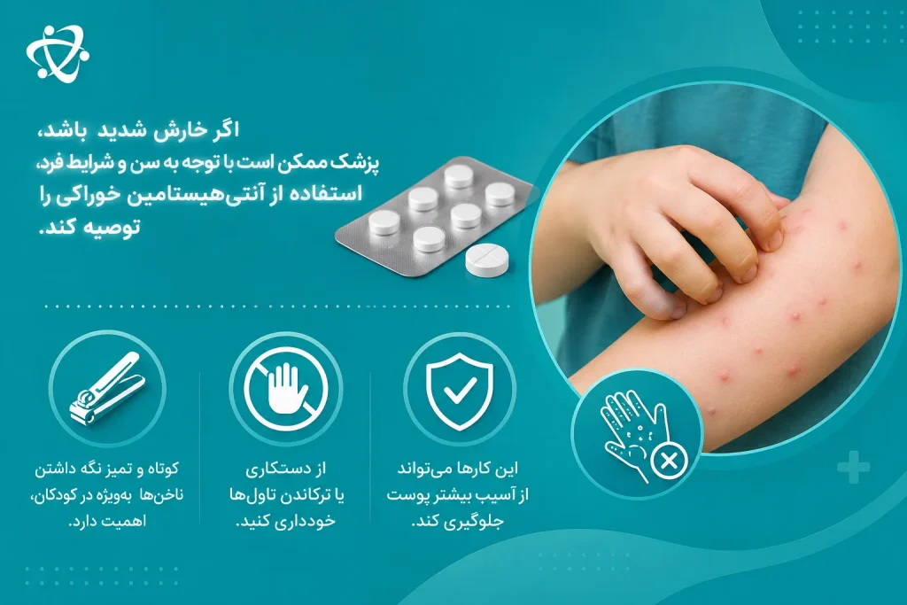درمان خارش آبله مرغان؛ آنتی‌هیستامین و مراقبت از تاول‌ها