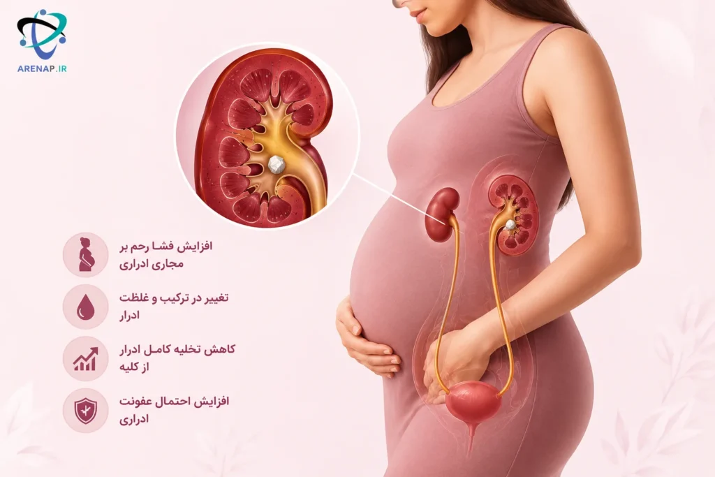 سنگ کلیه در زنان و بارداری چیست؟-arenap