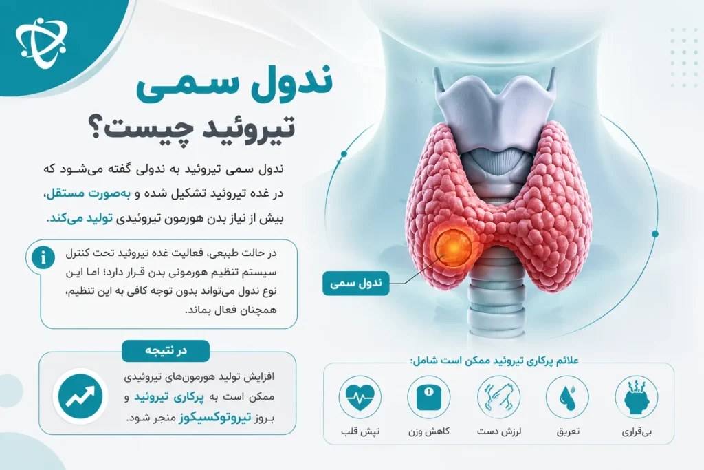 ندول سمی تیروئید؛ علت مهم تیروئید سمی و تولید بیش‌ازحد هورمون‌های تیروئیدی