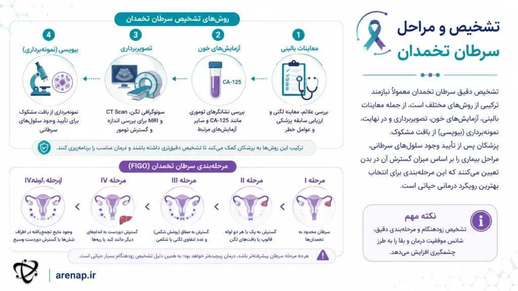 روش‌های تشخیص و مرحله‌بندی سرطان تخمدان - arenap
