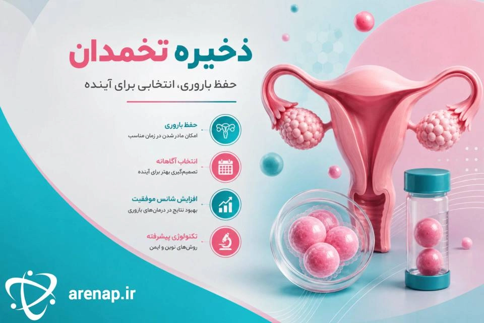 ذخیره تخمدان چیست - آرناپ