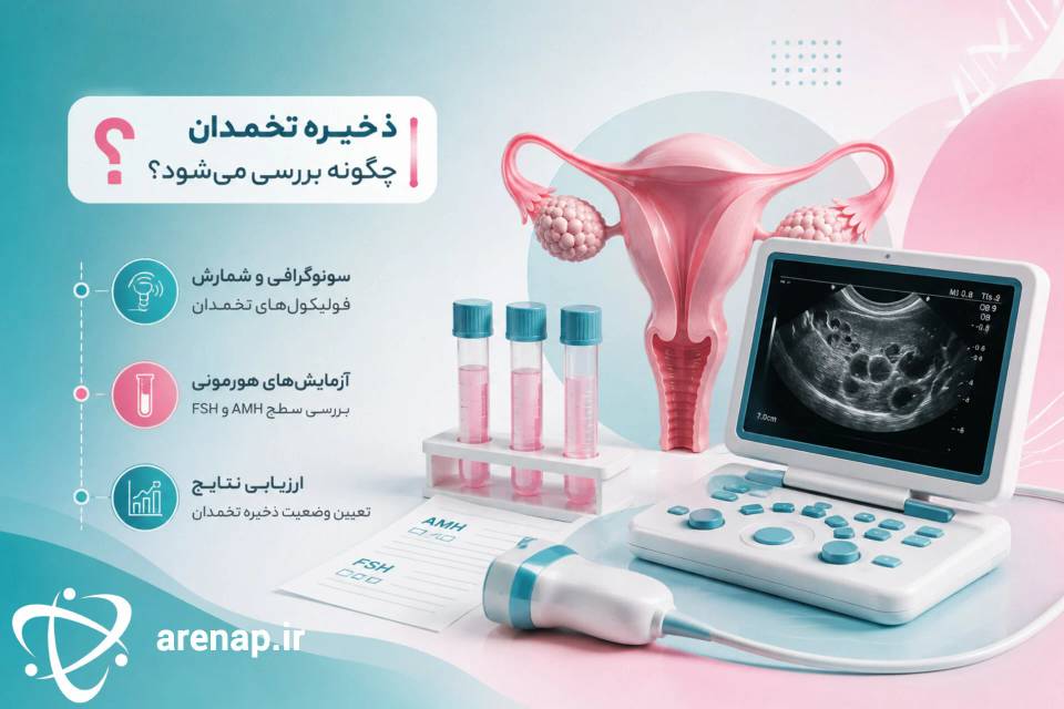 ذخیره‌ تخمدان چگونه بررسی می‌شود؟- ارناپ