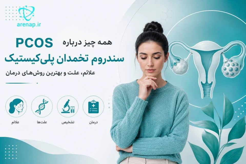 تصویر شماتیک سندروم تخمدان پلی‌کیستیک و تأثیر آن بر هورمون‌ها و تخمدان-ارناپ