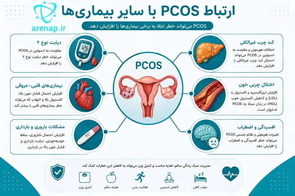اینفوگرافیک ارتباط سندروم تخمدان پلی‌کیستیک با دیابت، کبد چرب و بیماری‌های قلبی-ارناپ