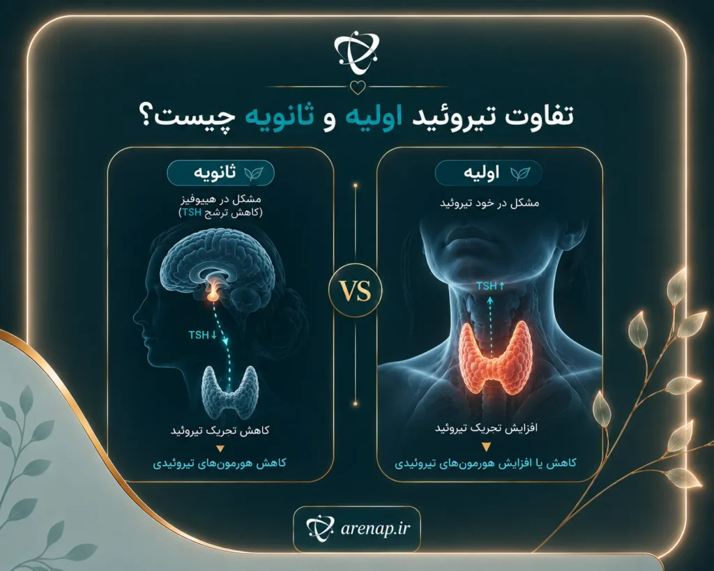 تفاوت تیروئید اولیه و ثانویه چیست-آرناپ