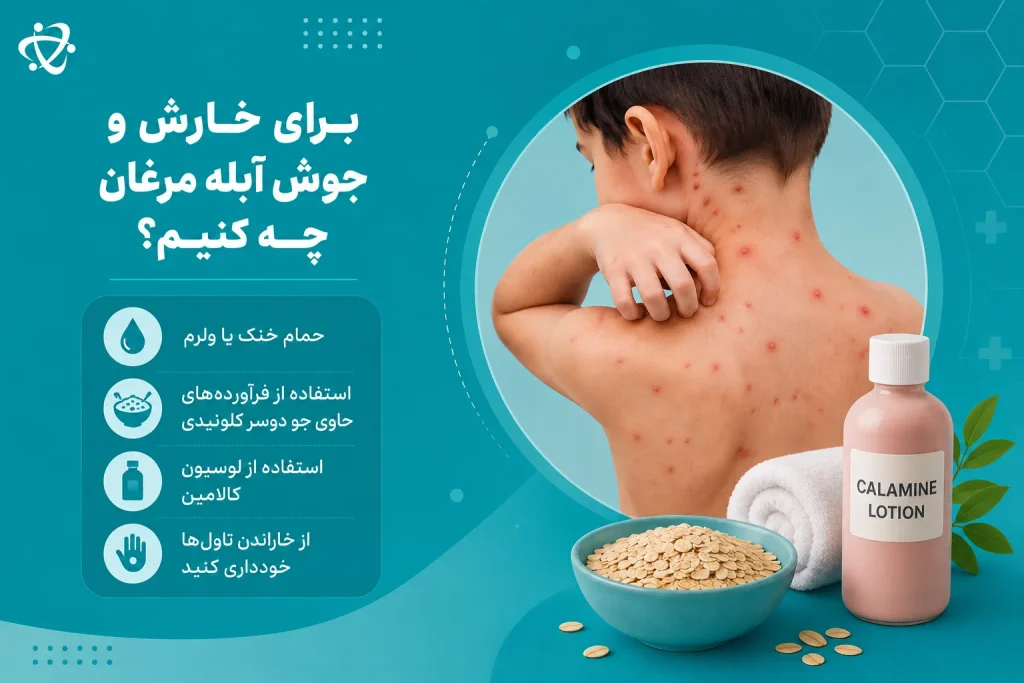 خارش آبله مرغان؛ راهکارهای کاهش خارش و مراقبت از تاول‌های پوستی