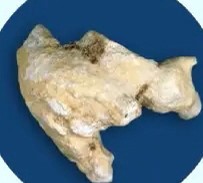 سنگ استروویت