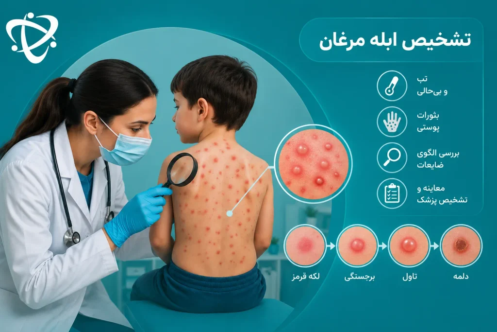 تشخیص آبله مرغان؛ بررسی بثورات پوستی و مراحل تبدیل لکه به تاول و دلمه