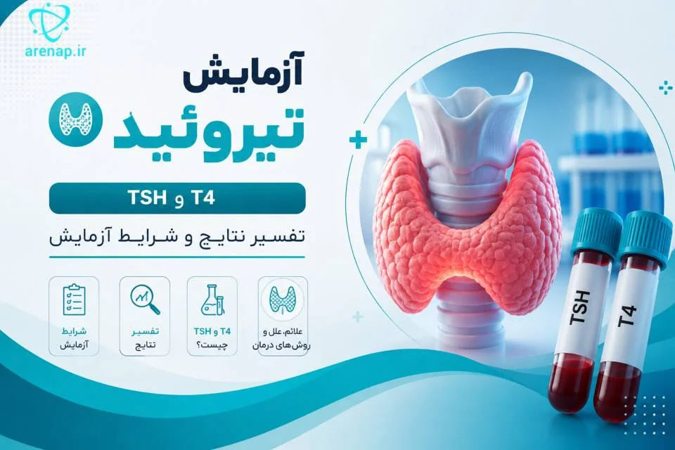 آزمایش تیروئید - آرناپ