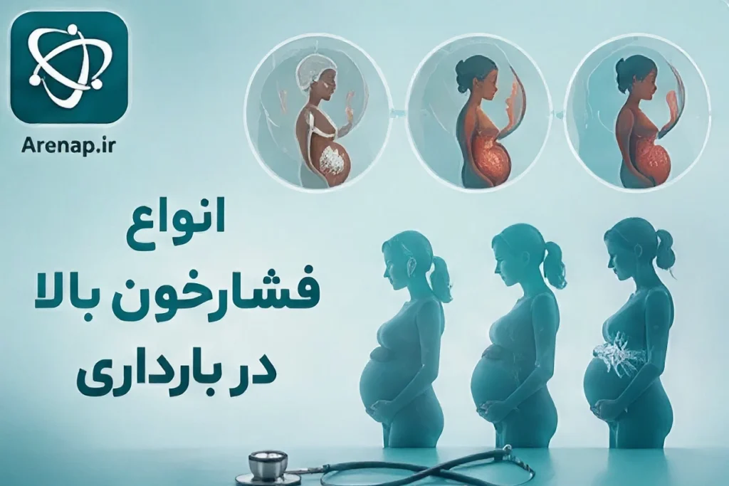 انواع فشارخون-ارناپ